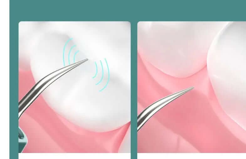 Nettoyeur Dentaire Visuel Haute Définition Les Visionnaires