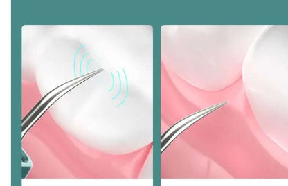 Nettoyeur Dentaire Visuel Haute Définition Les Visionnaires